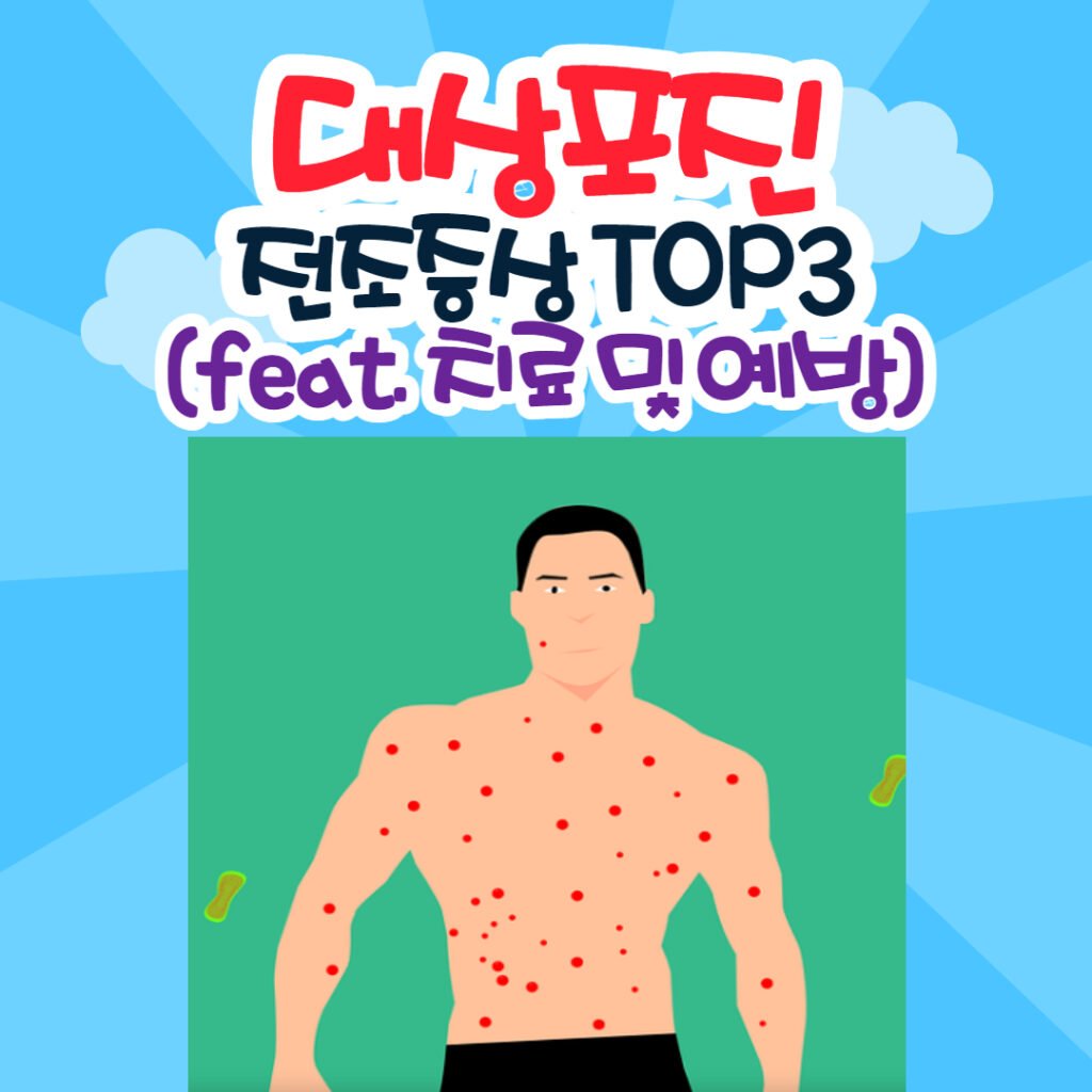 대상포진 전조 증상